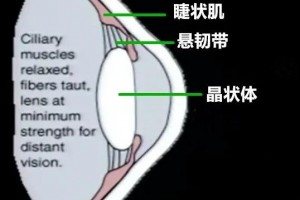 一文看懂什么是散瞳为何需求散瞳