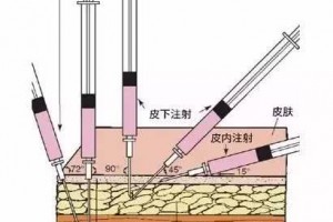 皮内皮下肌肉注射有啥差异