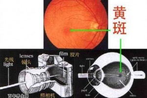 科普身价过亿你眼里这块斑竟是眼科医生的心头肉